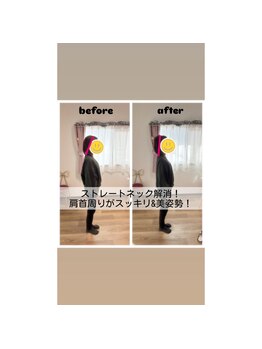 カラダリリース 浜松店/肩・首凝り改善