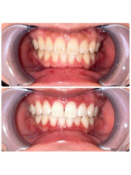 コナホワイトニング 神保町/ホワイトニング神保町