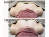人気No.1【離れ胸・左右差】巻き肩改善×筋膜リリースでふっくら上向きバスト