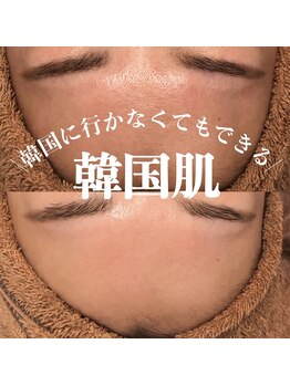 タマンサリ(Taman Sari)の写真/韓国肌管理で理想の肌へ！都度払いで小顔ケアNo1のレッドショットやツヤ肌ララピールを体験して輝く肌へ☆
