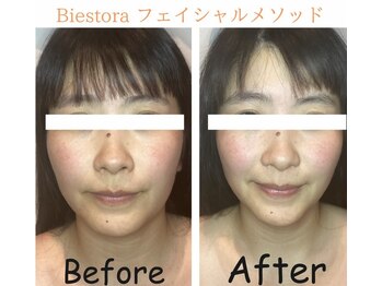 ビエストラ(Biestora)/石膏パックは大人気です