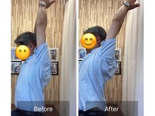 ナオル整体 札幌院(NAORU整体)/札幌円山/整体/猫背/巻き肩