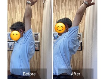 ナオル整体 札幌院(NAORU整体)/札幌円山/整体/猫背/巻き肩