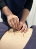 【１か月以内の再来でお値打ちに】膝、股関節鍼灸施術　30分　5830円