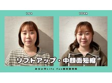ライフファン鍼灸接骨院 みらい平(Life Fun鍼灸接骨院)/
