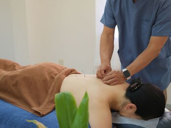 ひふみ鍼灸院/鍼施術