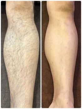 グラナダ 2F(Granada)/