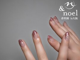 変形フレンチ オーロラ
