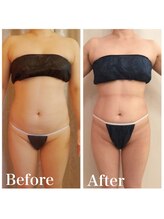 クイーン 熱海店(Queen)/60分寝ているだけでお腹ホッソリ