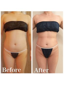 クイーン 熱海店(Queen)/60分寝ているだけでお腹ホッソリ