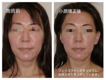 プラスホワイト 久我山の雰囲気（小顔矯正/熟練された手技とマシンにて1回の施術でも効果実感！）