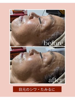 えすて処 灯香/〈ACトリートメント〉