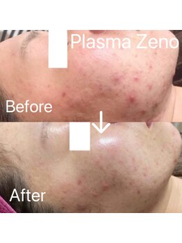 エステサロン ベルジュール/