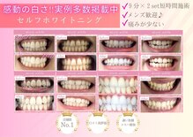 エクシアホワイトニング 浜松店