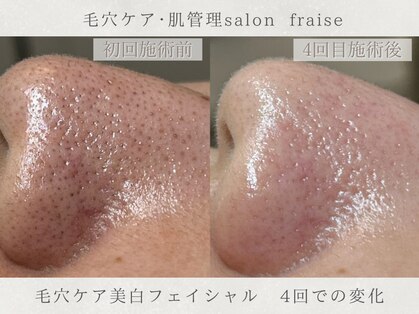 フレーズ(fraise)の写真