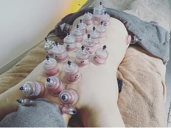 センシズ(Senses)/カッピング