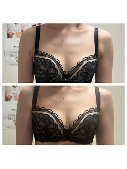 ジュエルリング(Jewel Ring)/バストアップ【恵比寿代官山】