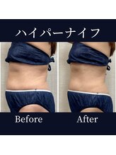 ハリルル 併設 GLケンタ鍼灸整骨院(HARILULU)/お正月太り改善