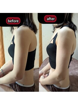 スノードロップ(snowdrop)/バストアップ　痩せ体型の方