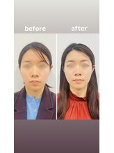 赤沼鍼灸整骨院/美・健康・笑顔に導く美容鍼