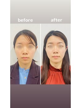 赤沼鍼灸整骨院/美・健康・笑顔に導く美容鍼