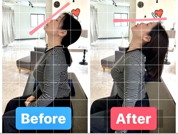 ナオル整体 兵庫院(NAORU整体)/神戸兵庫/施術事例【首こり】