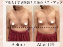 プレジィールの雰囲気（産後のバストのハリ、垂れたバストのお悩み解決しバストを上げる）