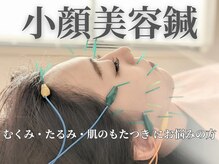 アキュベル 薬院(Acubelle Yakuin.)