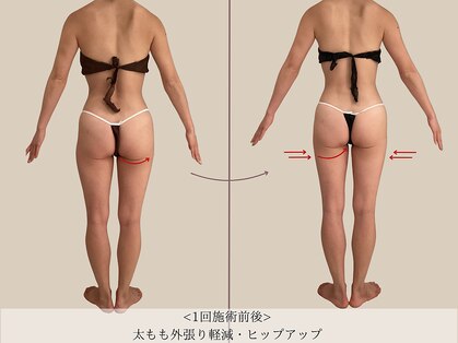 エル 麻布十番(LllL)の写真