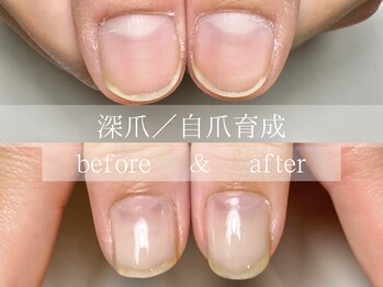 ル リアン 北浦和(le lien)/深爪育成(4ヶ月／6回)