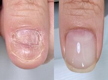 スイ(sui.)の雰囲気（10ヶ月の変化です。凸凹だったお爪も綺麗に生え変わりました。）