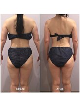 ナレル(narrel)/(新潟市/骨盤/痩身/ダイエット)