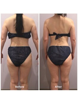 ナレル(narrel)/(新潟市/骨盤/痩身/ダイエット)