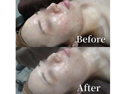 ボーソリューション(Beau-Solution)の写真