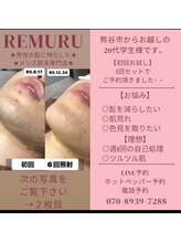 リムル(REMURU)/20代前半の学生　6回目