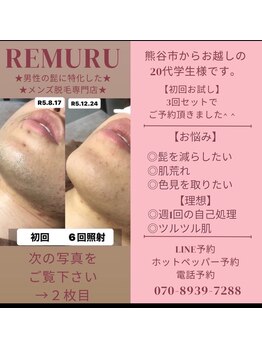 リムル(REMURU)/20代前半の学生　6回目