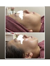 ビガク(BIGAKU)/艶肌