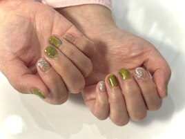 パラジェルベース施術写真