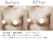 シエル(Siele)/痩せ型でバストがつかない！