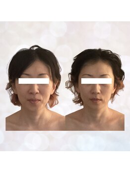 ビスイ 恵比寿(Bisui)/恵比寿/小顔矯正/コルギ