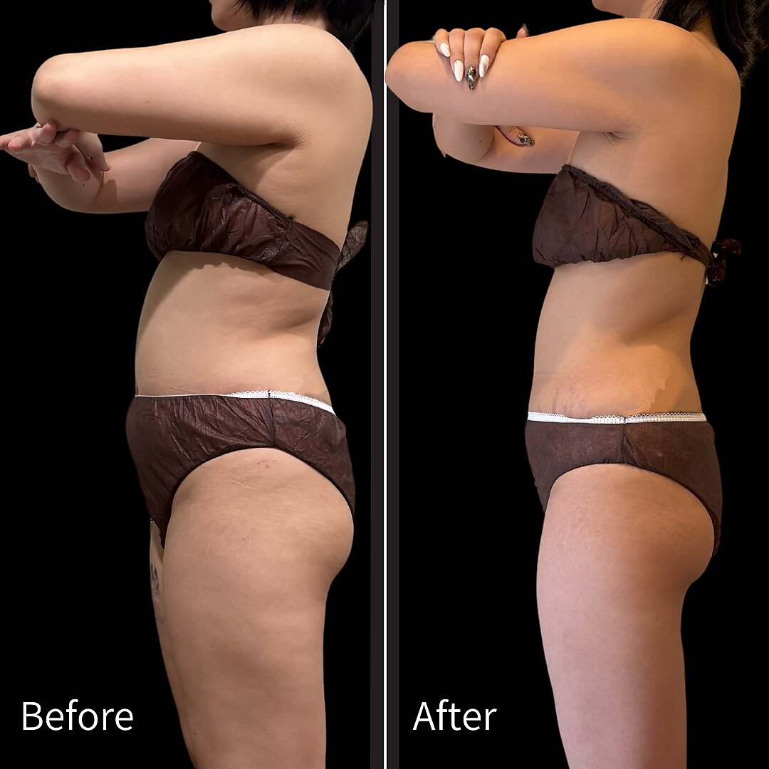 クールヴィラ(Cool Villa)｜ホットペッパービューティー