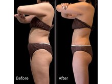 クールヴィラ(Cool Villa)