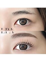 レピア 郡山駅前店/韓国式LEPIA Before&After