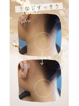 キアラ 麻布十番(Kiara)/麻布十番/毛穴/脱毛/顔脱毛