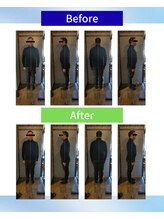 ライフファン鍼灸接骨院 みらい平(Life Fun鍼灸接骨院)/ビフォーアフター