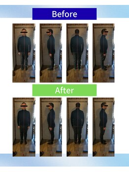 ライフファン鍼灸接骨院 みらい平(Life Fun鍼灸接骨院)/ビフォーアフター