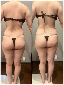 しずくの写真/【結果重視！大人痩身】本格デトックス★リラクゼーション×痩身効果ですっきりボディへ！