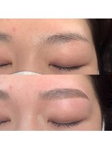 アンベリール(embellir)/ハリウッドブロウリフト(HBL)