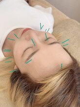 ヒーリングサロン アージュ(A-je)/★美顔鍼＋小顔矯正★