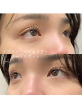 フィール(feel)/メーテルロット